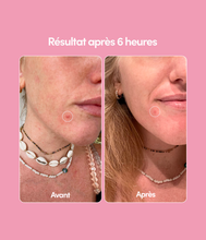 3 x 24 Patchs Boutons holo