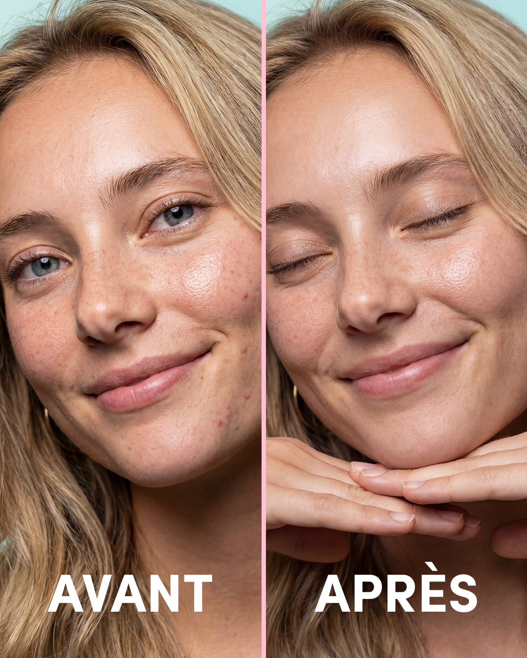 Duo Blemish Patches + Nose Patches