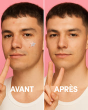 24 Patchs Boutons holo